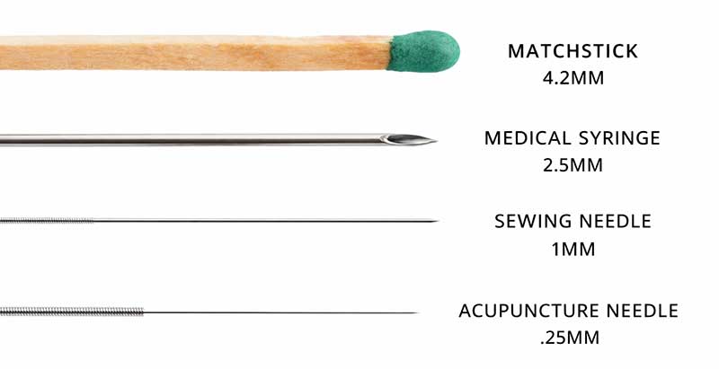 Acupuncture needle size