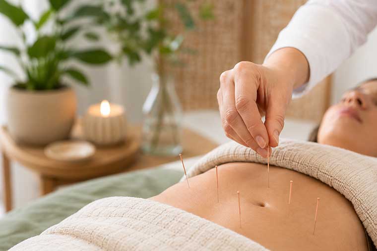 acupuncture for stomach issues